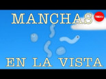 ¿Qué son esas cositas que parecen manchas en la vista?
