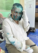 Golpean, rompen los dedos y rapan la cabeza a la periodista rusa que lleva años documentando los abusos en Chechenia