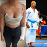 El juzgado prioriza el análisis forense de las supuestas lesiones de una chica a dos policías y no la rotura del brazo de ellos a la joven