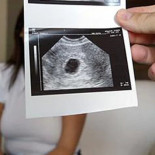 Atender un parto por WhatsApp: una aseguradora privada, condenada por mala praxis por la muerte de un recién nacido