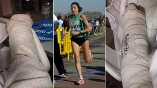 "Casi me comen viva": una atleta sufre en Gijón el brutal ataque de dos perros, ahuyentados con disparo al aire