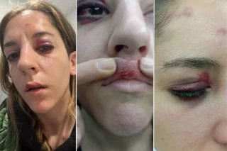 Joana, víctima de la paliza de un mosso al intentar detener el desahucio de su amiga: "La Policía criminaliza la pobreza"