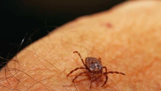 Muere el paciente español con fiebre hemorrágica contagiado por la picadura de una garrapata