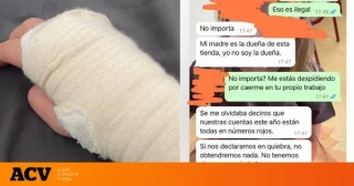 La despiden por sufrir un accidente laboral y le dan esta excusa para no pagarle indemnización: "Para tener un trabajo así prefiero no trabajar"