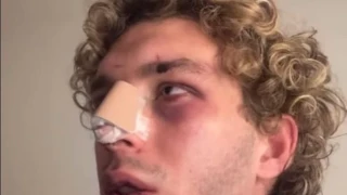 Agresión homófoba Valencia: Un joven denuncia una brutal paliza en un ataque homófobo: "Pensaba que me moría"