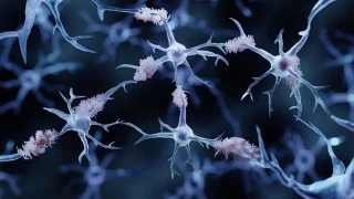 Identifican a la microglia oscura como factor clave de la enfermedad de Alzheimer (eng)