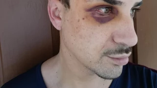 Un joven es agredido al salir de una discoteca en Murcia: "Me gritó Dame lo que lleves, maricón"