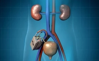 Crean riñón bioartificial que podría salvar millones de vidas: primer prototipo supera las pruebas preclínicas