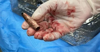 'Zona de niños muertos': Cirujanos estadounidenses regresan de Gaza y no pueden olvidar la pesadilla [EN]