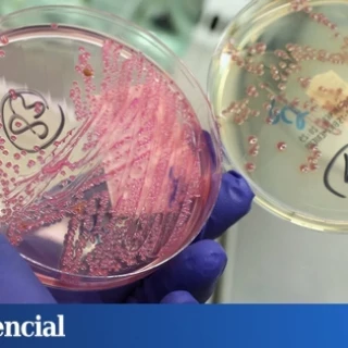 Hallan por primera vez una explicación al aumento del cáncer de colon en jóvenes: esta bacteria silenciosa