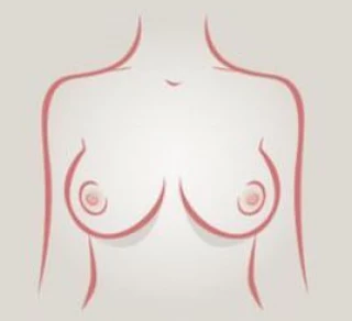 Los 9 tipos de senos (con ilustraciones)