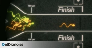 Carreras de espermatozoides, el último episodio de la obsesión de la ‘machosfera’ con el semen