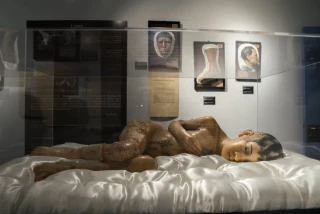 La universidad madrileña echa de sus instalaciones al Museo Olavide, una joya de la historia de la medicina, con figuras de cera de cientos de pacientes con pavorosas enfermedades