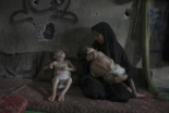 El hambre ataca los cuerpos de estos niños en Gaza [ENG]