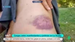 Olga Díaz, manifestante agredida por un policía, muestra sus heridas en MVT: "Me duele más por dentro que los golpes"