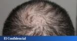 Un nuevo suero capilar realmente hace crecer el pelo en dos semanas, dice un estudio