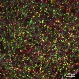 Un estudio revela cómo un mecanismo de defensa antiviral podría provocar la enfermedad de Alzheimer [ENG]