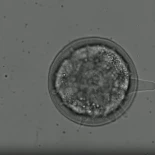 ¿Cómo se mueve una ameba con caparazón ?  (ENG)