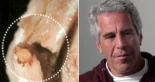 Fotos de la autopsia de Jeffrey Epstein revelan lesiones fuertes en el cuello