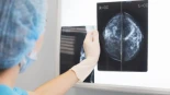 Más frecuente, pero menos letal: la mortalidad por cáncer de mama cayó un 42 % en España en las últimas tres décadas