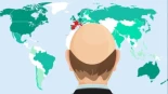 ¿Qué países del mundo tienen más hombres calvos? [MAPA]