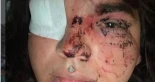 Una mujer trans sufre una «brutal agresión» grupal al grito de «travelo de mierda» en La Bañeza (León)