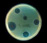 Un antibiótico descubierto por casualidad podría ser la clave para combatir bacterias superresistentes