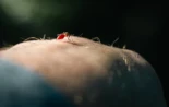 Científicos descubren que los mosquitos regulan su apetito a través de su ano