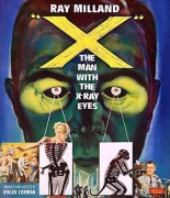 El hombre con rayos X en los ojos (Corman, 1963)