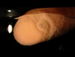 Una verruga se abre tras ser sumergida en agua