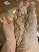 Esto es un pie después de haber llevado puesto unas botas mojadas durante 10 horas