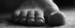 Lisfranc, el cirujano que amputaba en 15 segundos