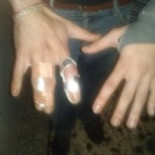 Un policía le rompe cuatro dedos a un gaiteiro durante una identificación y le impiden presentar denuncia