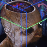 La nueva 'biblia de la Psiquiatría' nace con polémica