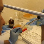 Terapia experimental reduce proteína vinculada al Alzheimer