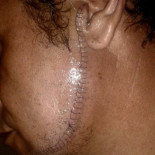 Un vecino de Recimil sufre una brutal agresión cuando intentaba defender a su nuera