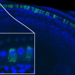 Curan la sordera genética sustituyendo un gen defectuoso por uno sano