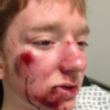 Atropella a joven ciclista y lo abandona porque llega tarde al colegio [ENG]