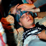 El marine "indignado" herido en la carga de Oakland, en estado grave