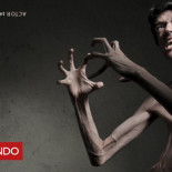 Qué es el síndrome de Marfan y cómo un actor español logró utilizarlo para cumplir un sueño