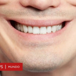 Qué es la "depresión sonriente" y por qué es más peligrosa que los otros tipos