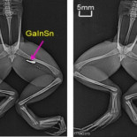 Un metal líquido para reparar nervios