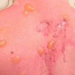 Al menos 50 heridos por lanzarse agua hirviendo creyendo que se congelaría