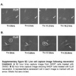 Células humanas viejas rejuvenecidas por revolucionario descubrimiento [ENG]