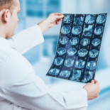 Resonancias magnéticas de los cerebros de 130 mamíferos, incluidos los humanos, indican una conectividad idéntica [eng]