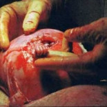 Profesor de la Universidad de Málaga enseña a los futuros médicos que el aborto está mal