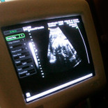 Decidí abortar cuando supe que mi bebé sería niño