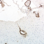 Aparecen más evidencias sobre la teoría de que el Alzheimer pueda transmitirse [ENG]