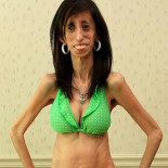 La mujer que tiene que comer cada 15 minutos para mantenerse con vida [ENG]