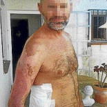 Una aseguradora reclama 5.000 euros a un Tedax herido en acto de servicio